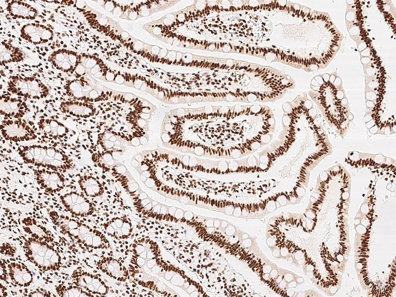 Polyclonal Rabbit anti-Human KLF7 Antibody (IHC)