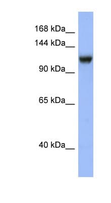 Polyclonal Rabbit anti-Human Mineralocorticoid Receptor Antibody (N-Terminus, WB)