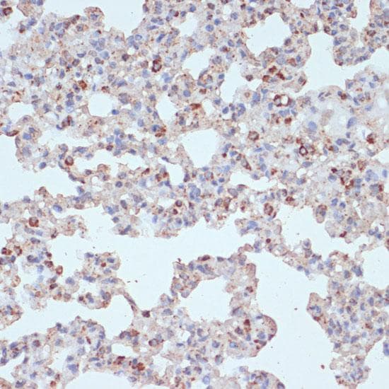 PDGFRB / PDGFR Beta Antibody