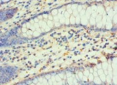 Polyclonal Rabbit anti-Human DLX3 Antibody (aa1-120, IHC)