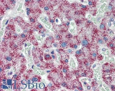 IHC-plus™ Polyclonal Rabbit anti-Human EIF3S5 / EIF3F Antibody (aa307-357, IHC, WB)