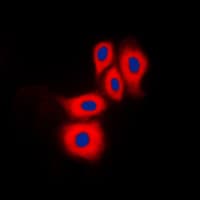 NOS3 / eNOS Antibody (phospho-Ser1177)