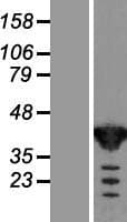 TSTA3 / GDP-L-Fucose Synthase Protein (Over-Expression Lysate Myc-DDK (Flag))