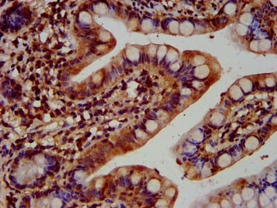 Polyclonal Rabbit anti-Human KTN1 / Kinectin Antibody (IHC, WB)