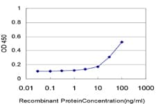 Monoclonal Mouse anti-Human MTA1 Antibody (clone 4D5, WB)