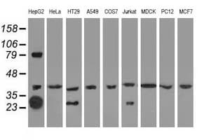 QPRT Antibody (clone OTI4E5)