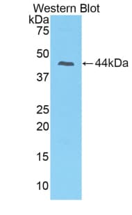 PIP / GCDFP-15 Antibody (aa1-146, APC)