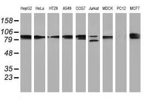 PRKCE / PKC-Epsilon Antibody (clone OTI2E9)
