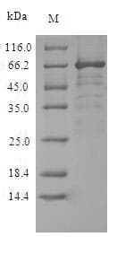 Nipah Virus gG Protein (Recombinant 10His, N-terminus + Myc, C-terminus)