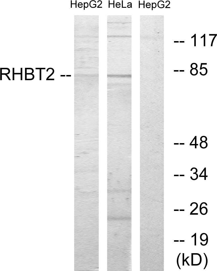 RHOBTB2 / DBC2 Antibody