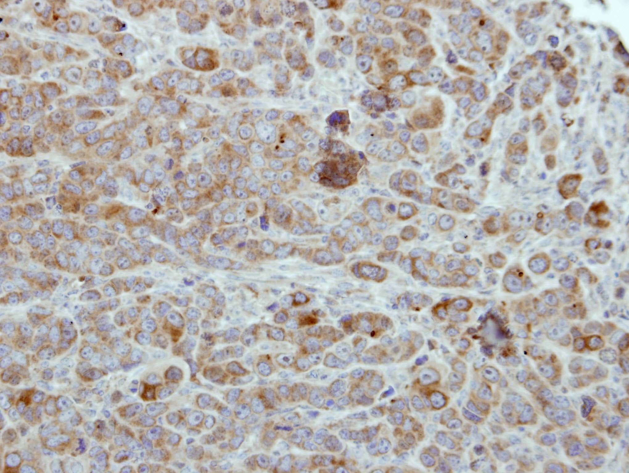 ULK2 Antibody (aa693-968)