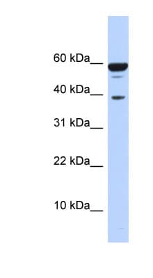 Polyclonal Rabbit anti-Human PPP1R8 / Rnase E Antibody (aa215-264, WB)