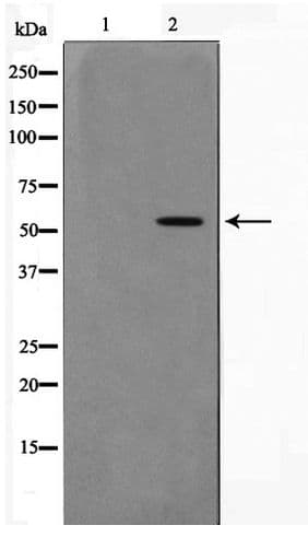 Polyclonal Rabbit anti-Human DUS2 / DUS2L Antibody (IHC, WB)