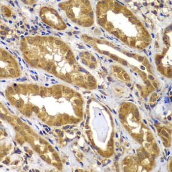 Polyclonal Rabbit anti-Human MMP14 Antibody (IHC, WB)