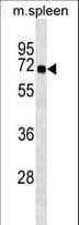 Polyclonal Rabbit anti-Human SNTB1 / A1B Antibody (aa243-271, WB)