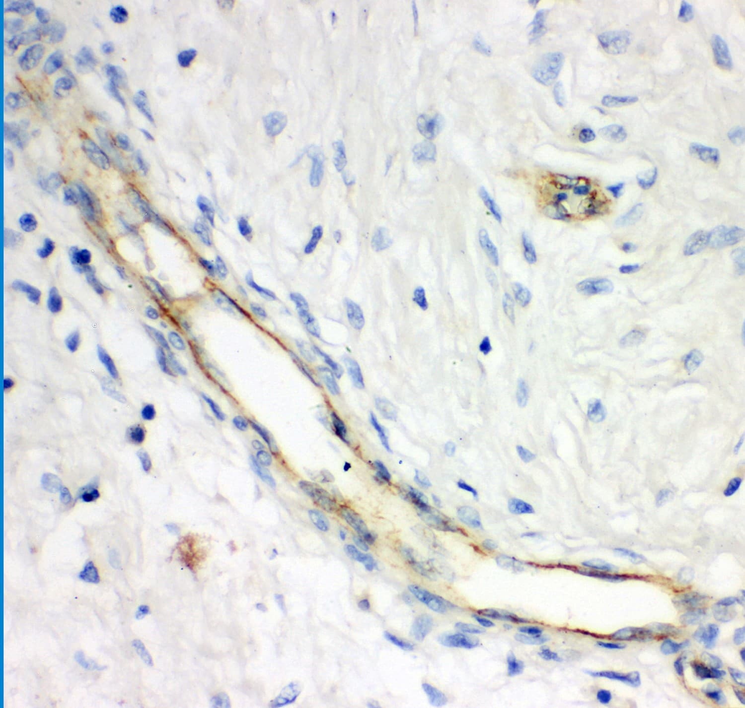 GCLC Antibody (aa437-637)