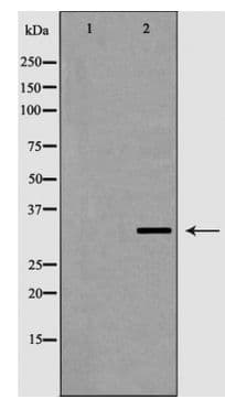 VDAC2 Antibody