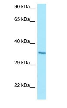 HT036 / HYI Antibody (C-Terminus)