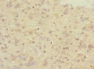 Polyclonal Rabbit anti-Human PCDH10 Antibody (IHC)