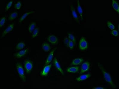 Polyclonal Rabbit anti-Human SLC52A2 / GPR172A / PAR1 Antibody