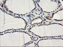 ILVBL Antibody (clone OTI1A12)