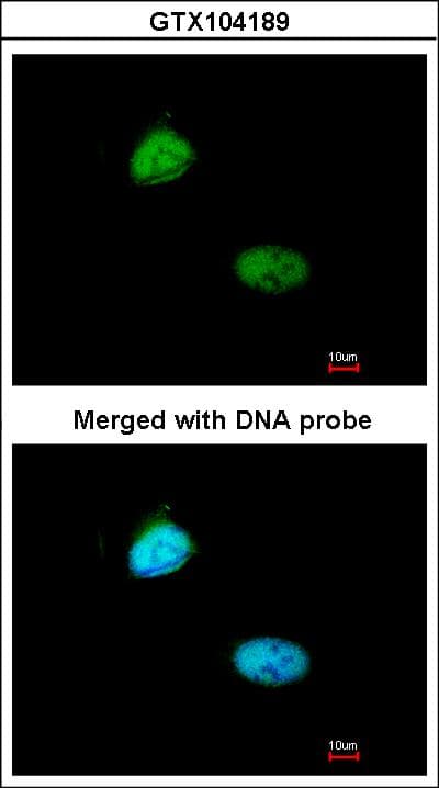 Polyclonal Rabbit anti-Human HMBOX1 Antibody (aa142-407, IHC, WB)