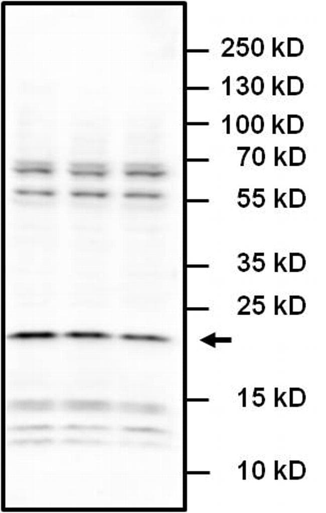 IL6 / Interleukin 6 Antibody