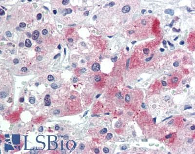 PACAP Antibody (aa1-175)