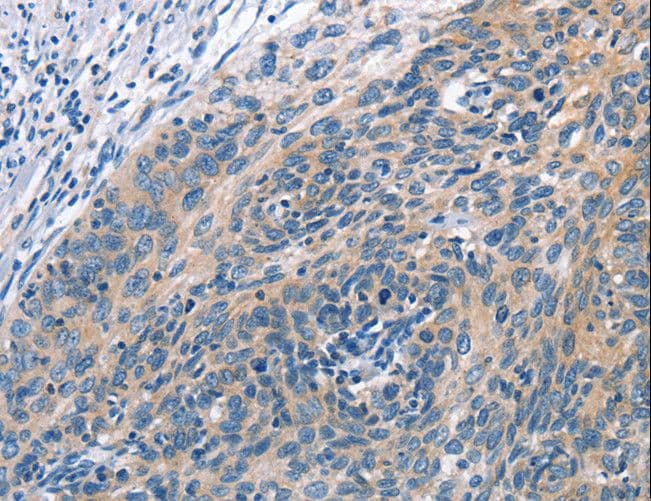 CUL7 Antibody