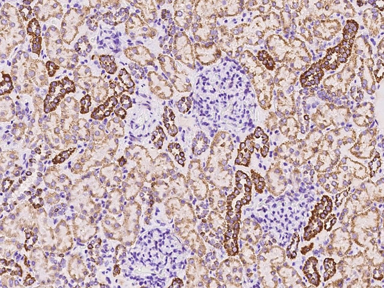 Polyclonal Rabbit anti-Human COXIV / COX4 Antibody (Preservative Free, IHC, WB)