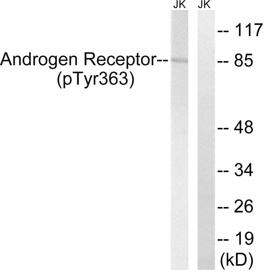 AR / Androgen Receptor Antibody (phospho-Tyr363)