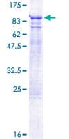 Human DDX59 Protein (Recombinant GST)