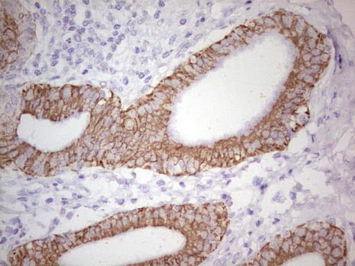 ABCB1 / MDR1 / P Glycoprotein Antibody (aa995-1280, clone OTI1A7)