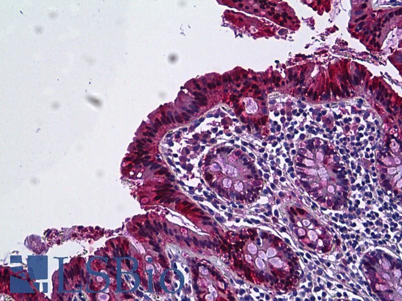 PathPlus™ LGALS3 / Galectin 3 Antibody (aa141-190)