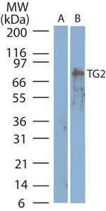 Polyclonal Rabbit anti-Human TGM2 / Transglutaminase 2 Antibody (aa600-650, IHC, WB)