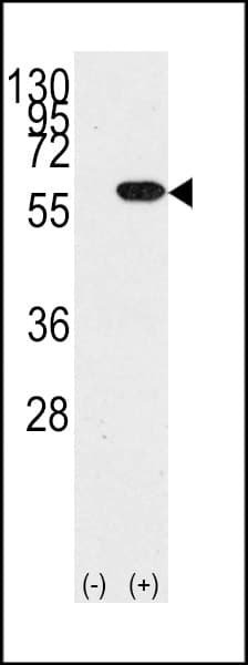 Polyclonal Rabbit anti-Human YBX1 / YB1 Antibody (aa58-87, WB)