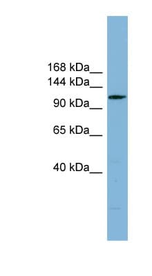 C14orf104 Antibody (aa35-84)