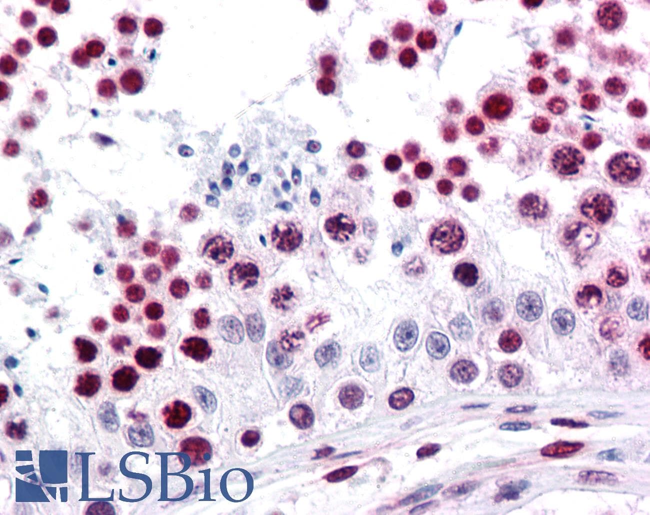 IHC-plus™ HMG1 / HMGB1 Antibody (clone 1D5)
