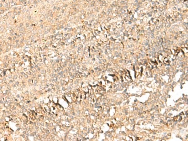 PSD4 Antibody