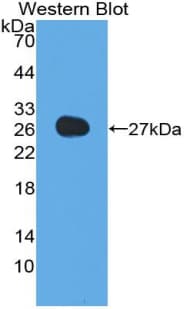 Adiponectin Antibody (aa32-244)