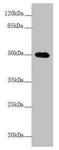 Polyclonal Rabbit anti-Human L2HGDH Antibody (IHC, WB)