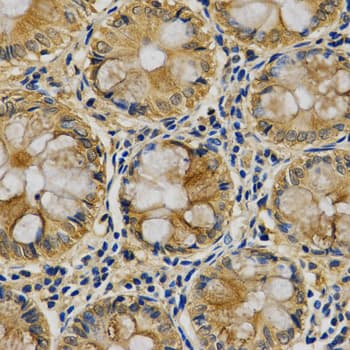 Polyclonal Rabbit anti-Human SERPINB5 / Maspin Antibody (IHC, WB)