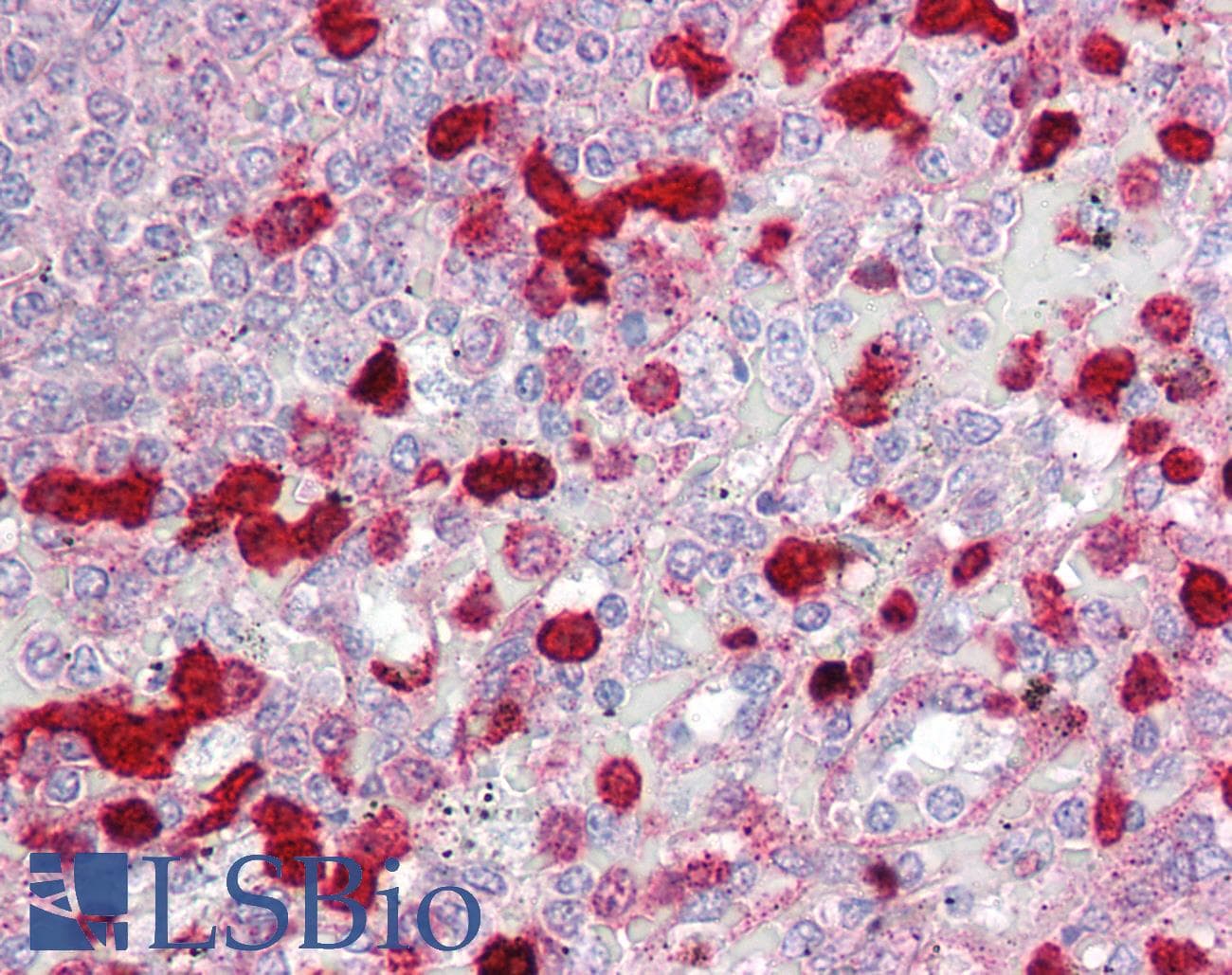 IHC-plus™ Polyclonal Rabbit anti-Human CLIC4 Antibody (aa1-50, IHC, WB)
