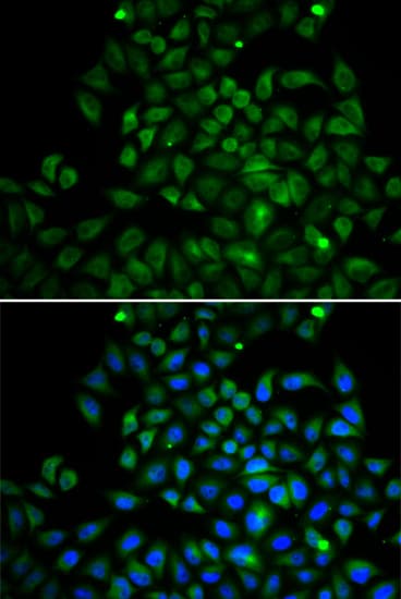Polyclonal Rabbit anti-Human FABP4 / AP2 Antibody (IHC, IF, WB)