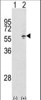 CCT3 Antibody (aa298-326)