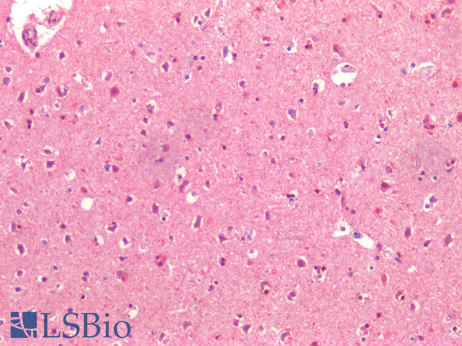 PathPlus™ BECN1 / Beclin-1 Antibody