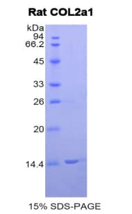 Rat COL2A1 / Collagen II Alpha 1 Protein (Recombinant His)