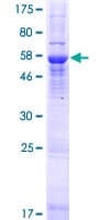 Human TOMM40L Protein (Recombinant GST)