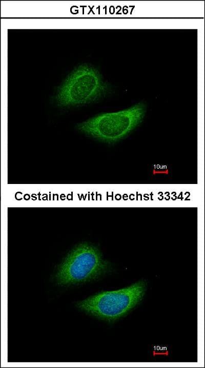 Polyclonal Rabbit anti-Human GLDC Antibody (aa442-723, IHC, WB)