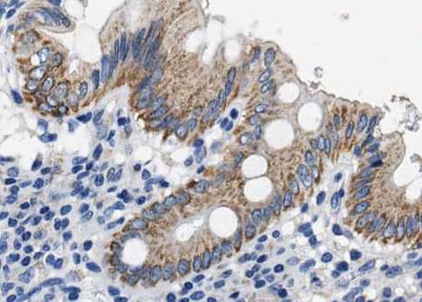 Polyclonal Rabbit anti-Human SDF1 / CXCL12 Antibody (IHC, WB)